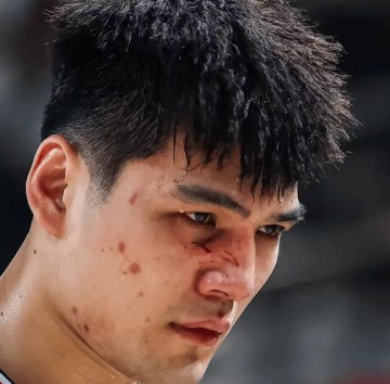 开云APP-伤痕明显！广州状元陈国豪面部骨裂 季后赛大概率戴面具对阵广东